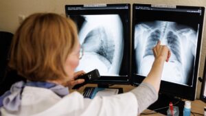 La respuesta del cuerpo a diferentes cepas de tuberculosis podría afectar a la transmisión, según un estudio